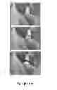 Fig. 02 - COMPOSITIONS AND METHODS FOR REPAIRING BONE