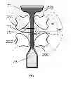 Fig. 06 - Methods for cleaning and tenderizing animal meat with shock waves