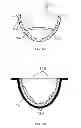 Fig. 10 - Methods for cleaning and tenderizing animal meat with shock waves