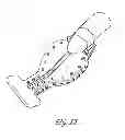 Fig. 02 - Intraoral device with stability bar