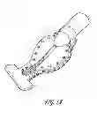Fig. 02 - Intraoral device