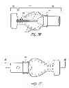Fig. 03 - Intraoral device