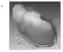 Fig. 01 - Pregnant abdominal system and associated devices, systems, and methods