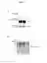 Fig. 09 - Targeting c-Rel O-GlcNAcylation and uses thereof