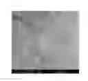 Fig. 02 - Embedding resin composition for electron microscopey and method for observing sample with electron microscope using the same