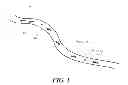 Fig. 02 - Compensation of motion-related error in a stream of moving micro-entities