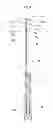 Fig. 05 - Living cell cryopreservation tool