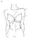 Fig. 02 - Support bustier garment