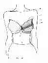 Fig. 09 - Support bustier garment