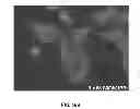 Fig. 43 - Materials and Methods Useful to Induce Vacuolization, Cell Death, or a Combination Thereof