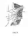 Fig. 03 - Methods and compositions for treating foot or hand pain