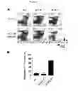 Fig. 04 - METHODS AND PHARMACEUTICAL COMPOSITIONS FOR TREATING LYMPHOID MALIGNANCY