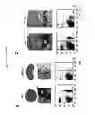Fig. 08 - METHODS AND PHARMACEUTICAL COMPOSITIONS FOR TREATING LYMPHOID MALIGNANCY