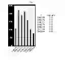 Fig. 09 - Method of treating hyperproliferation of cells using a nucleolin specific aptamer