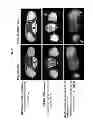 Fig. 29 - Method of treating hyperproliferation of cells using a nucleolin specific aptamer