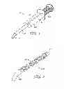 Fig. 02 - DENTAL AUTO-MIXING METHOD, DEVICE, AND COMPOSITION FOR TEMPORARY CEMENTS