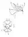 Fig. 02 - Minimally open retraction device