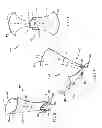 Fig. 07 - Minimally open retraction device