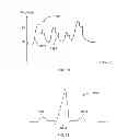 Fig. 13 - WAVELET-BASED SYSTEM AND METHOD FOR ANALYZING A PHYSIOLOGICAL SIGNAL