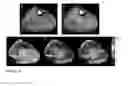 Fig. 11 - CEST MRI methods for imaging glutaminolysis in cancer