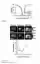 Fig. 12 - CEST MRI methods for imaging glutaminolysis in cancer