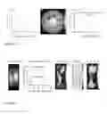 Fig. 14 - CEST MRI methods for imaging glutaminolysis in cancer
