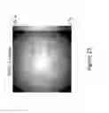 Fig. 19 - CEST MRI methods for imaging glutaminolysis in cancer