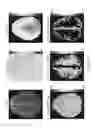 Fig. 21 - CEST MRI methods for imaging glutaminolysis in cancer
