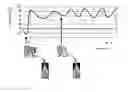 Fig. 01 - Thoracic drainage device having reduced counter-pressure