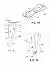 Fig. 05 - Disposable absorbent article with profiled absorbent core