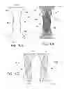 Fig. 17 - Disposable absorbent article with profiled absorbent core