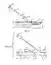 Fig. 06 - Systems and methods for venipuncture and catheter placement