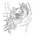 Fig. 01 - Method and apparatus for treatment of human urinary incontinence