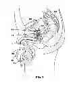 Fig. 02 - Method and apparatus for treatment of human urinary incontinence