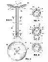 Fig. 03 - Method and apparatus for treatment of human urinary incontinence