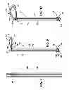 Fig. 04 - Method and apparatus for treatment of human urinary incontinence
