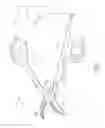Fig. 02 - Bipolar electrosurgical hand shears