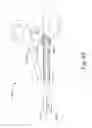 Fig. 35 - Bipolar electrosurgical hand shears