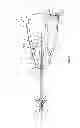 Fig. 02 - SURGICAL SPACER INSTRUMENT AND METHOD