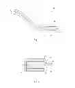 Fig. 02 - Thrombus removal apparatus