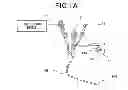 Fig. 02 - OPERATIVE METHOD FOR LUMEN