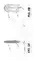 Fig. 06 - Aortic great vessel protection