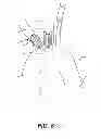 Fig. 09 - Aortic great vessel protection