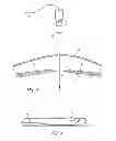 Fig. 03 - Percutaneous hernia repair