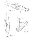 Fig. 04 - Percutaneous hernia repair