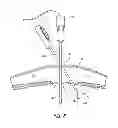 Fig. 05 - Percutaneous hernia repair