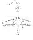 Fig. 07 - Percutaneous hernia repair