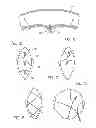 Fig. 10 - Percutaneous hernia repair