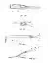 Fig. 12 - Percutaneous hernia repair