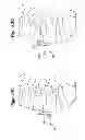 Fig. 04 - Orthopaedic plate